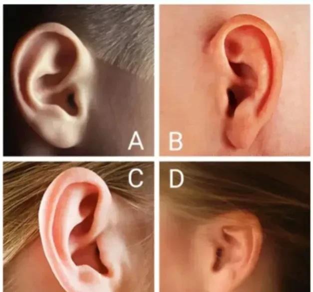 Chọn 1 chiếc tai giống của bạn để biết bạn sinh ra có mang số giàu hay không
